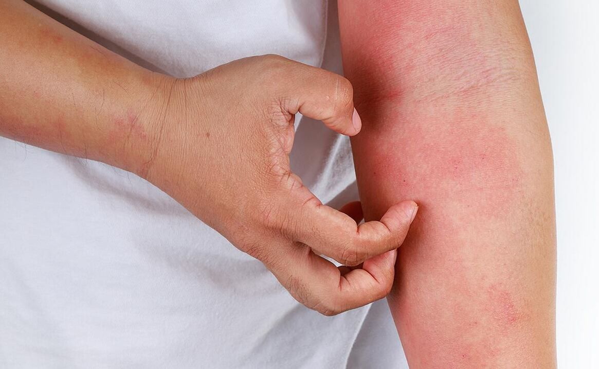 mögliche Komplikationen durch die Verwendung von Limonade