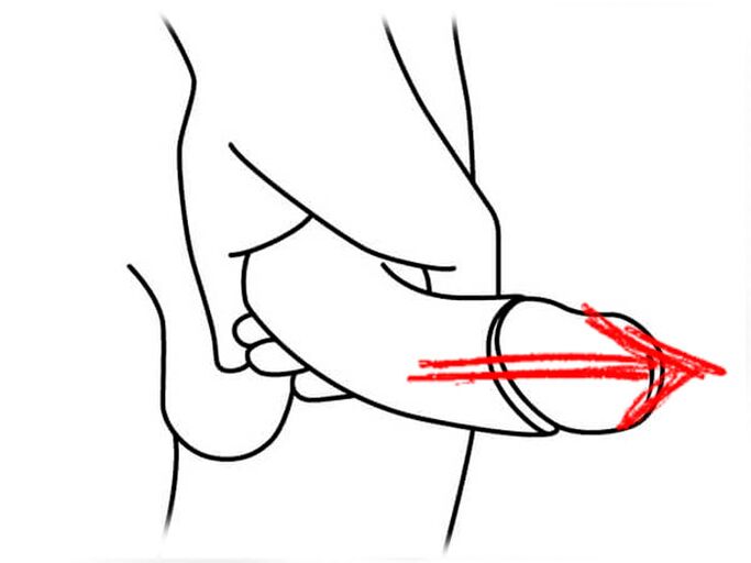 Dehnung des Penis zur Vergrößerung